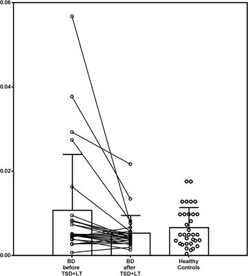 Effective Antidepressant Chronotherapeutics (Sleep Deprivation and Light Therapy) Normalize the IL-1β:IL-1ra Ratio in Bipolar Depression